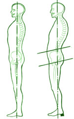 falsche haltung durch Schuhe